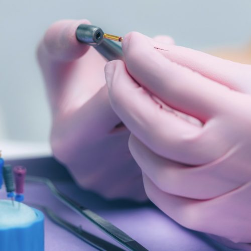 An Endodontist Holding Barbed Broach, Root Canal Treatment in Dental Clinic.