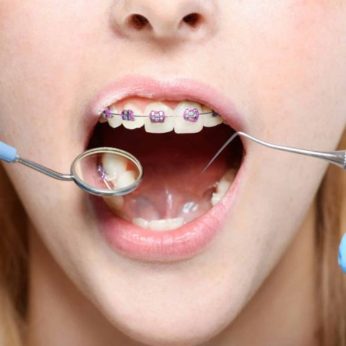 Cropped shot of dentist in latex gloves using a mouth mirror and periodontal probe on woman with Cropped shot of dentist in latex gloves using a mouth mirror and periodontal probe on woman with