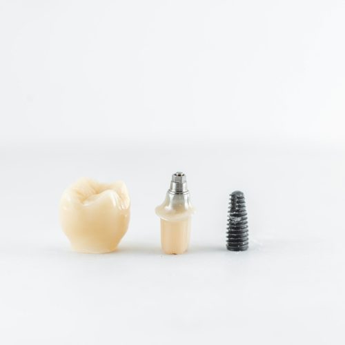Dental implant with screw and crown Dental implant with screw and crown