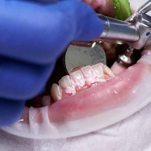 Doctor cleaning and polishing patient teeth in dental clinic. Doctor cleaning and polishing patient teeth in dental clinic.