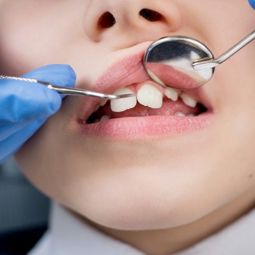 Female dentist examines the teeth of the patient child