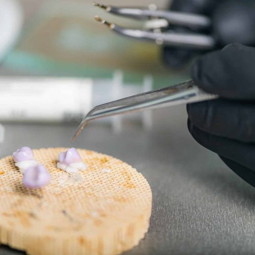 Teeth Prosthodontics. Teeth Crowns Prepared for Oven and Press. Teeth Prosthodontics. Teeth Crowns Prepared for Oven and Press.