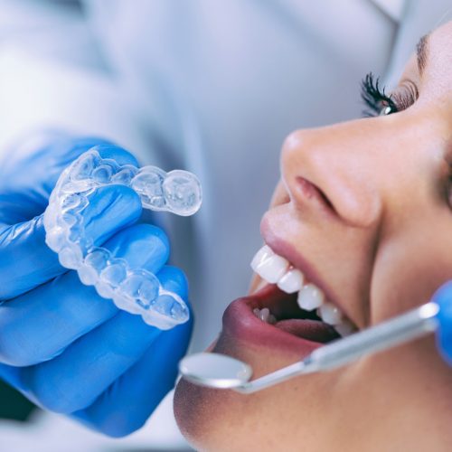 Teeth Whitening Procedure